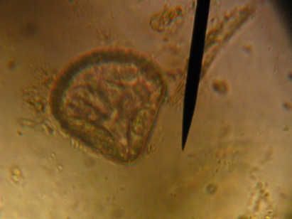 Tapeworm in a fecal exam.